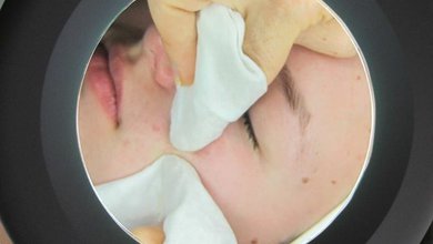 Hĺbkové čistenie pleti solanie.jpg